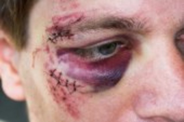 auge.jpg